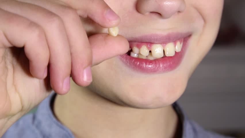 دودھ کے دانت: مسائل اور ان کا حل