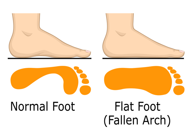 خم پائوں ہموار خلا