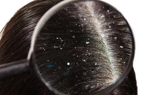 وجہ لیموں نشوونما دواؤں