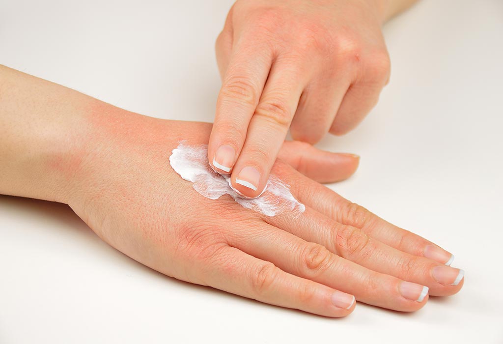 چنبل کے لئے مفید قدرتی اشیاء