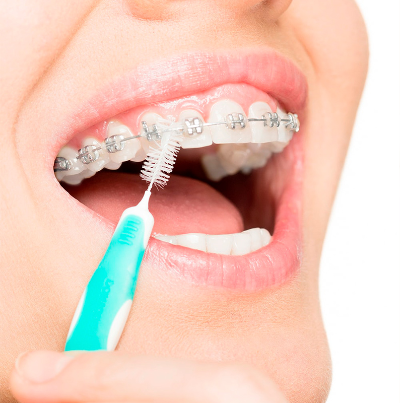 بریسز صفائی