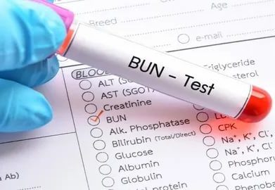 بن ٹیسٹ کیا ہے کن افراد کے لیے