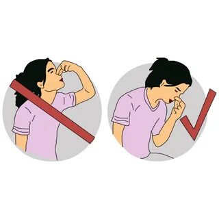 نکسیر ابتدائی طبی امداد