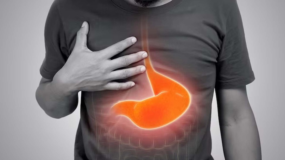 تیزابیت کم کرنے والی غذائیں-شفانیوز