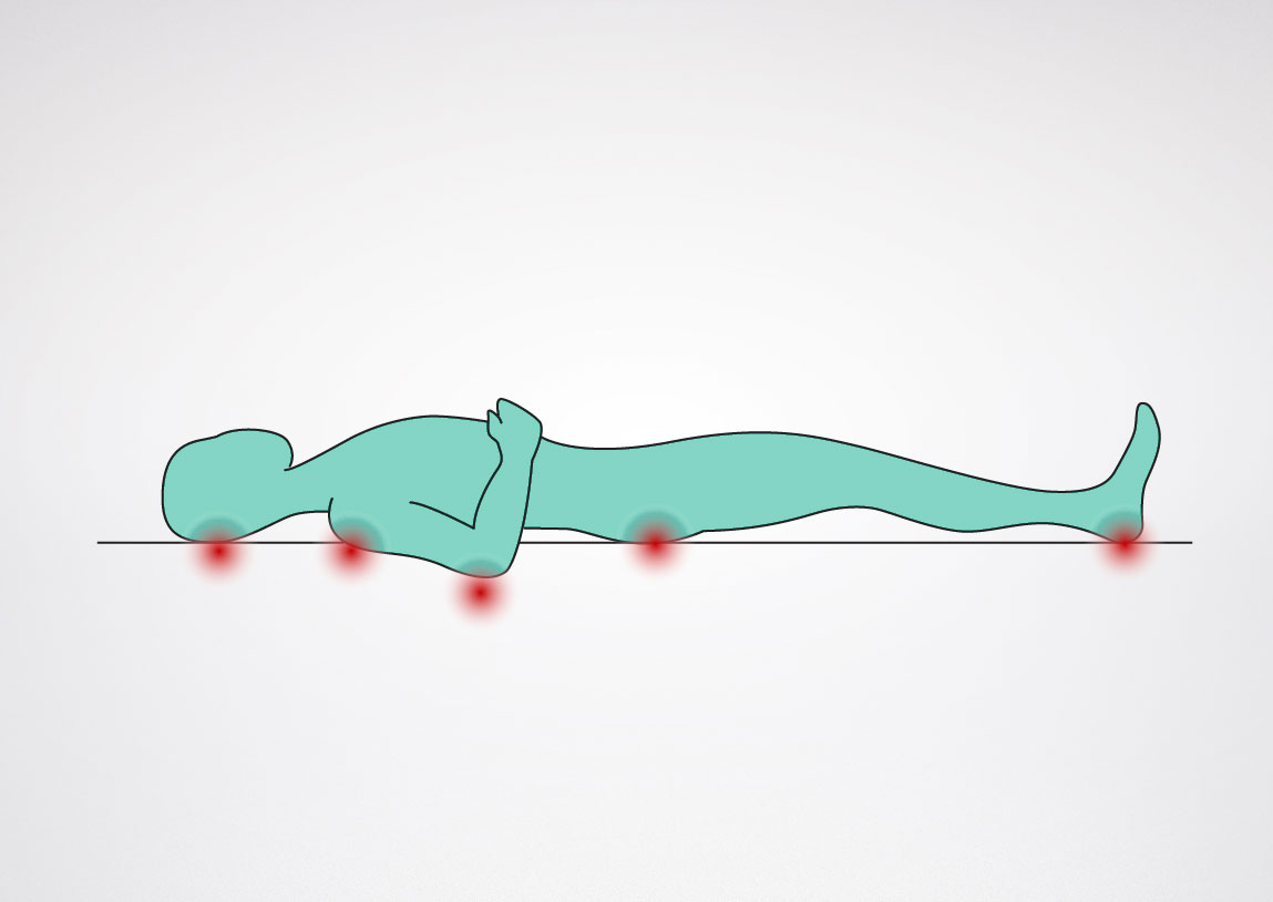 پریشر السر: بچاؤ اور گھر پر دیکھ بھال