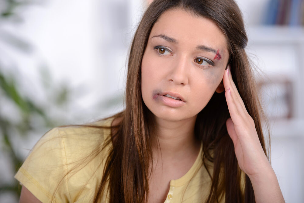 چہرے پر زخم-شفانیوز