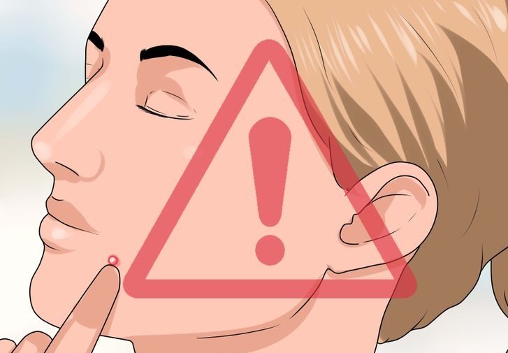   دانے چھیلنے سے سکن خراب