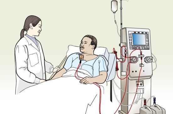 عید اور ڈائلیسز کے مریض