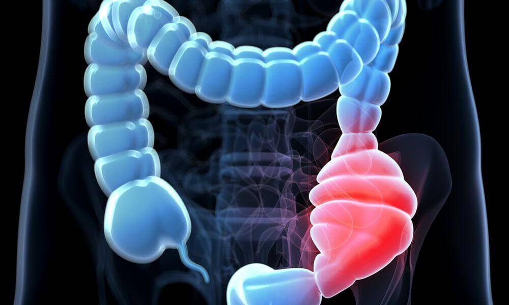 دائمی قبض اور غذائی احتیاطیں