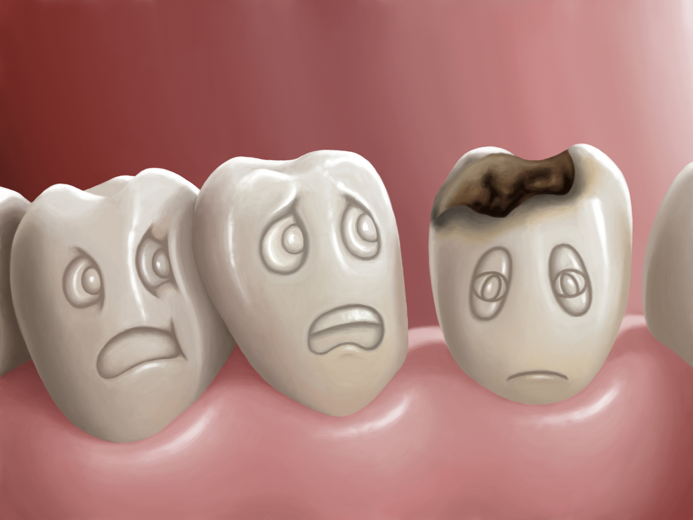 دانتوں کی 10عام بیماریاں
