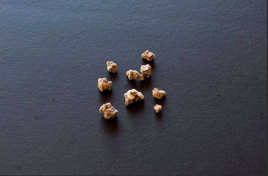 گردوں کی پتھری