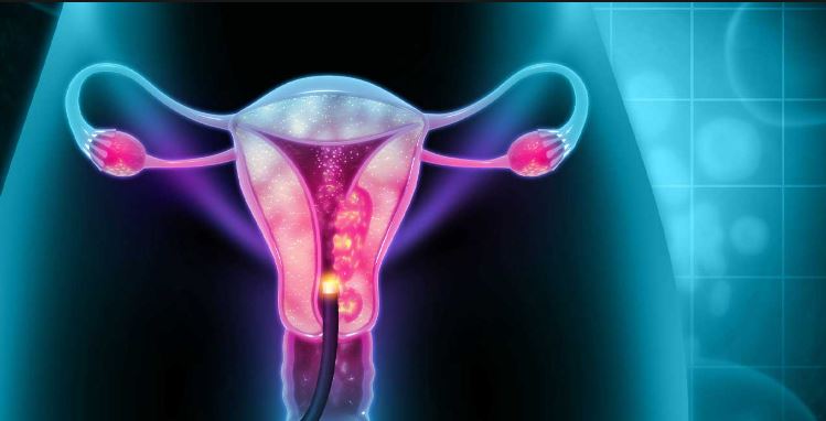 سروائیکل کینسر