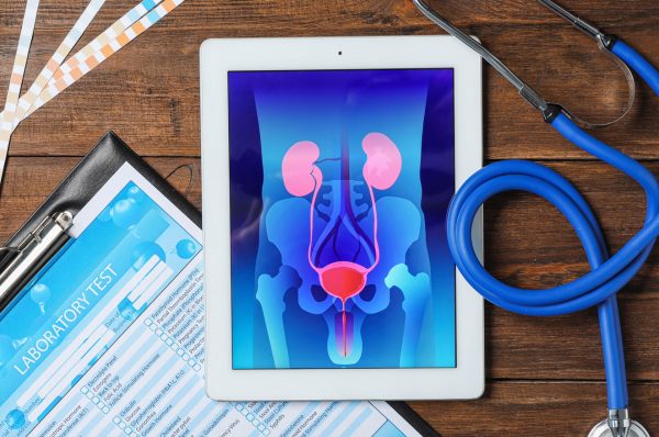 Urological issues in men