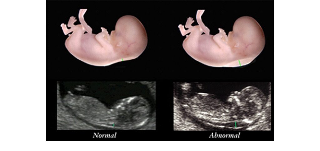 سی وی ایس-شفانیوز