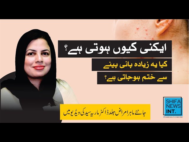 ایکنی کیوں ہوتی ہے؟ | کیا یہ زیادہ پانی پینے سے ختم ہو جایی ہے؟