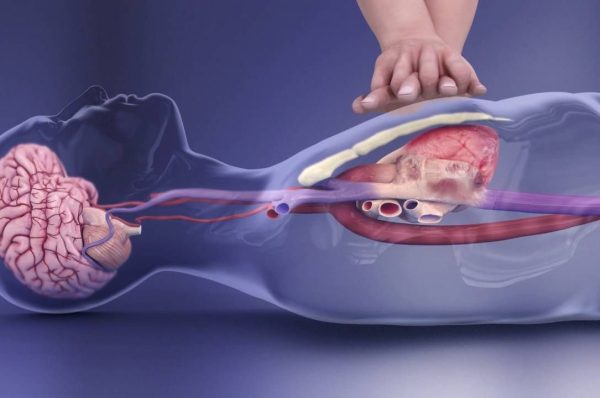 Basic life support (BLS)