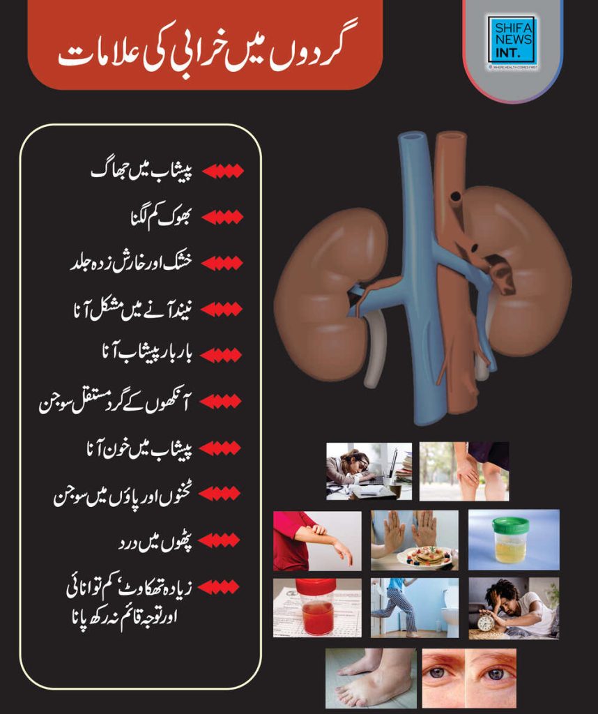 گردوں میں خرابی کی 10 علامات-شفانیوز