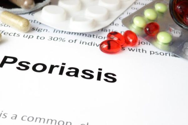 Psoriasis: Causes, Symptoms & Management