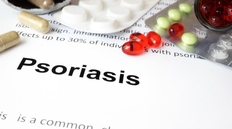 Psoriasis: Causes, Symptoms & Management