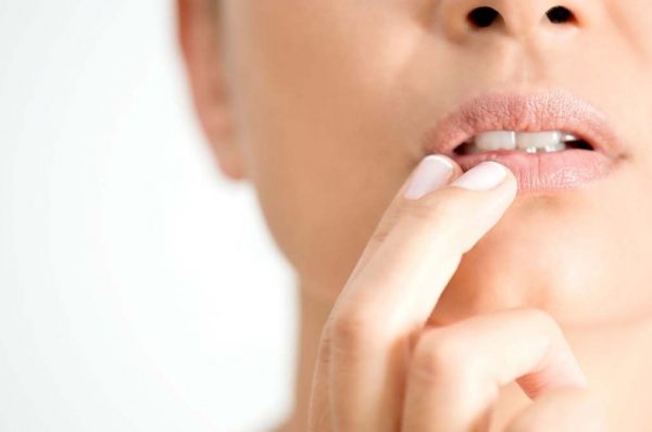 Cold Sores: Causes & Treatment