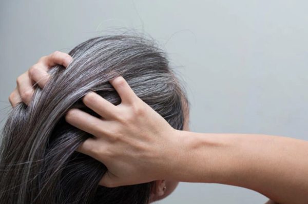 Premature graying of hair
