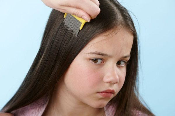 Head lice