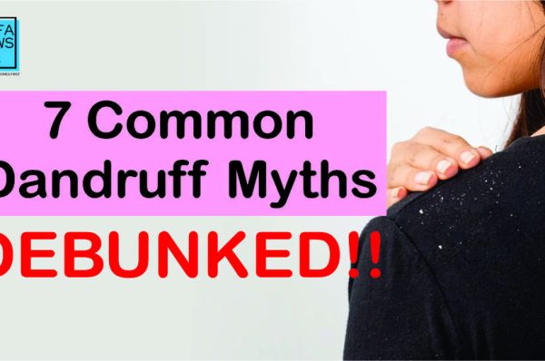 Common myths about dandruff