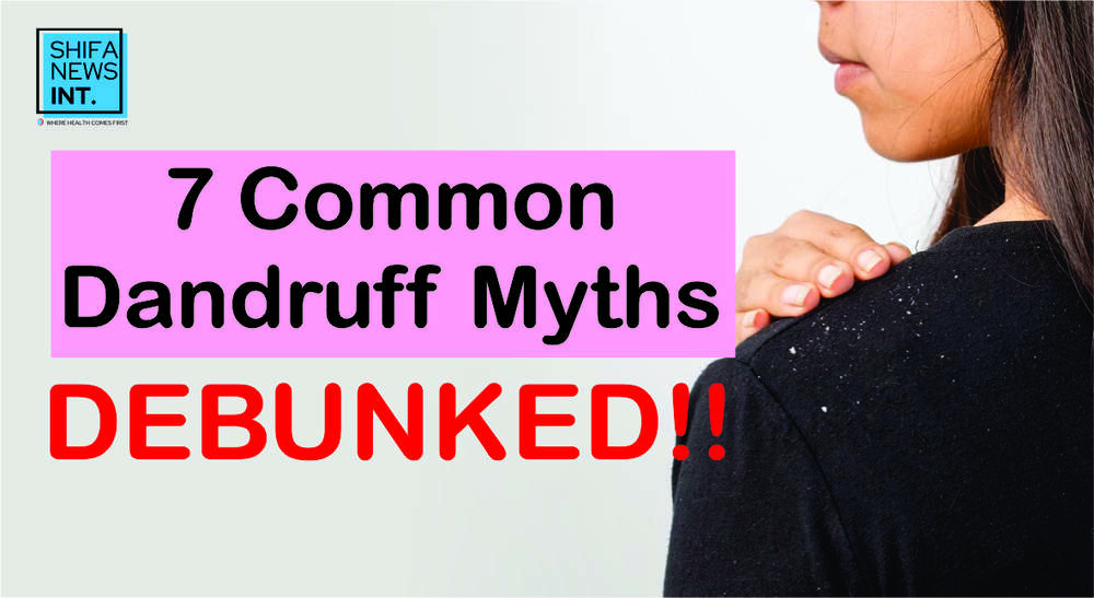 Common myths about dandruff