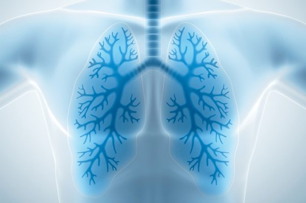 Lung diseases in Pakistan