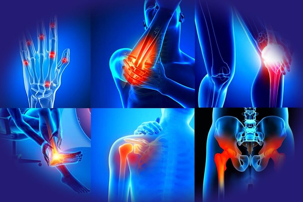 جوڑوں میں درد -شفانیوز
