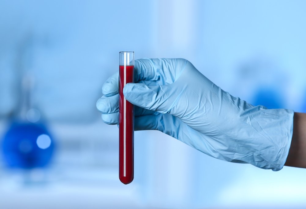 خون سے متعلق حیرت انگیز حقائق