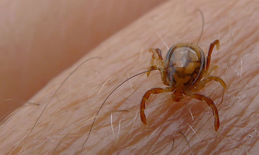 پاکستان میں کانگو وائرس – شفا نیوز