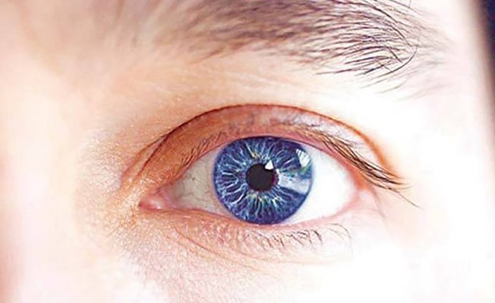 سری لنکا سے آنکھوں کے 5 قرنیوں کا تحفہ- شفا نیوز