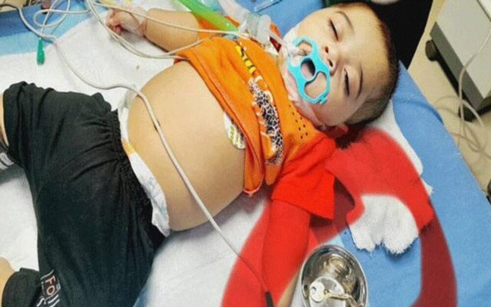 ڈاکٹروں نے 5 ماہ کے بچے کے پیٹ سے چابی نکال لی – شفا نیوز