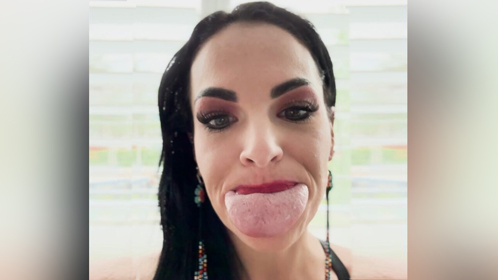 زبان کی ایک نایاب بیماری کا ریکارڈ ٹوٹ گیا