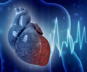 ایٹریل فبلیریشن- شفا نیوز 