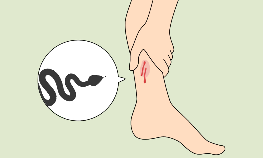 سانپوں کی وجہ سے پاکستان میں سالانہ 8 ہزاراموات- شفانیوز