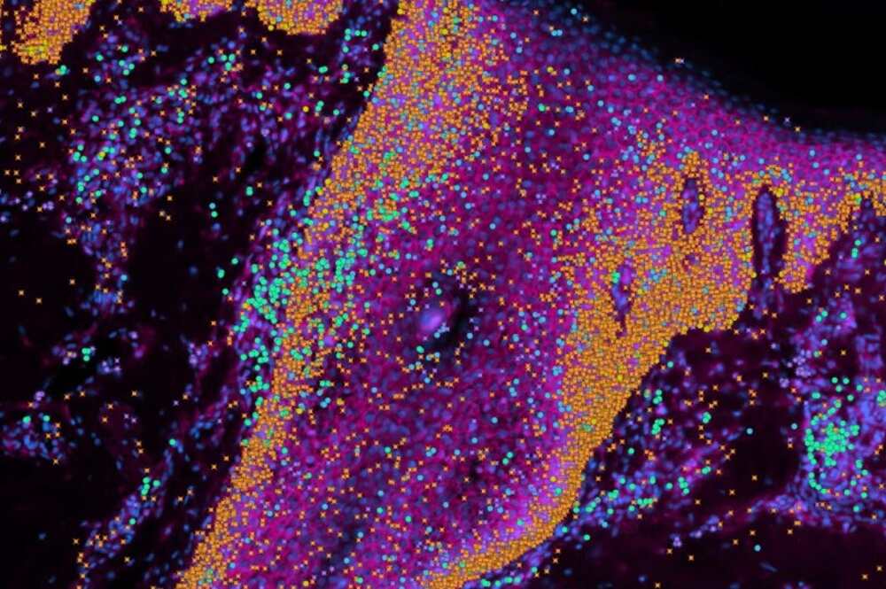 جلد کا جدید نقشہ، داغ ہمشہ کے لیے ختم- شفا نیوز