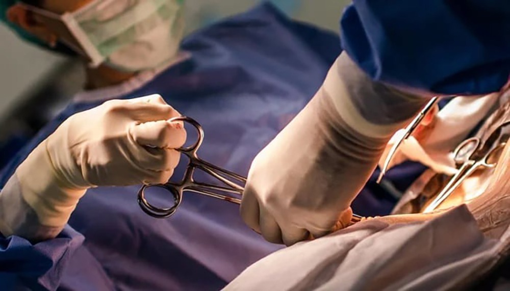 دو سروں والی 10 دن کی بچی کا کامیاب آپریشن- شفا نیوز