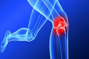 اے سی ایل انجری- شفا نیوز