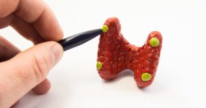 ہائپر پیرا تھائیرائیڈ ازم- شفا نیوز