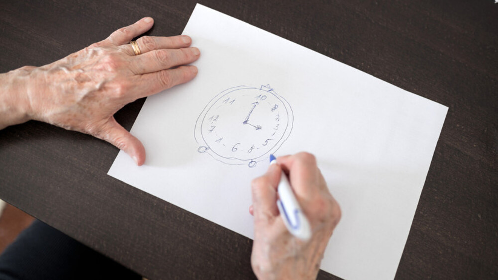 آسان ڈرائنگ ٹیسٹ سے بھولنے کے مرض کی تشخیص۔ شفا نیوز