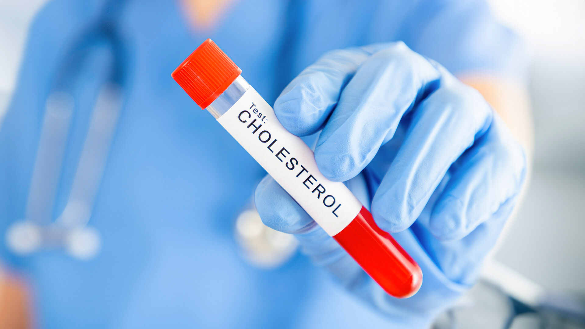 جلد کی بیماری، ہائی کولیسٹرول کی ایک ممکنہ علامت