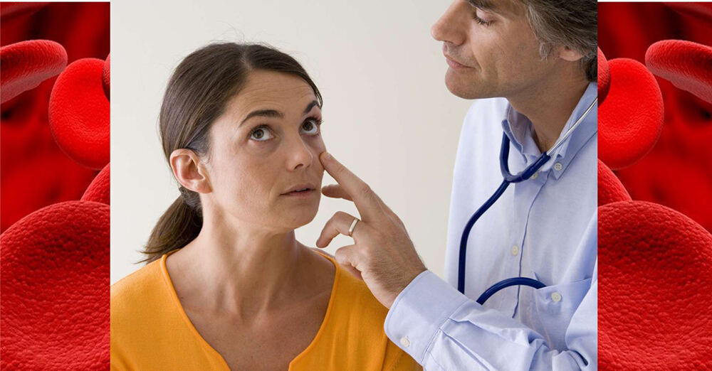 انیمیا سے عالمی نقصان 3 ارب ڈالر سے تجاوز کر گیا- شفا نیوز