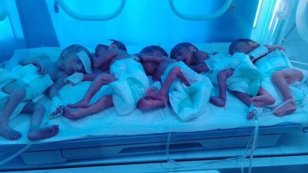 بنوں میں خاتون کے ہاں 5 بچوں کی پیدائش- شفا نیوز