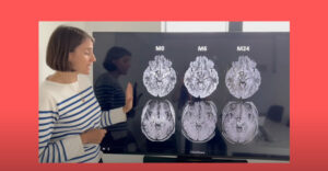 ایڈرینو لوکو ڈسٹروفی: اعصابی اور غدودی بیماری- شفا نیوز