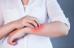 الرجی: مدافعتی نظام کا غیر معمولی ردعمل - شفا نیوز