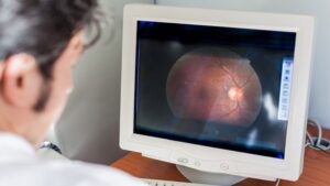 ڈرائی میکیولر ڈیجنریشن: عمر بڑھنے کےساتھ مرکزی نظر کی کمزوری- شفا نیوز