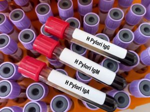 ایچ پائلوری (ہلیکوبیکٹر پائلوری) انفیکشن- شفا نیوز