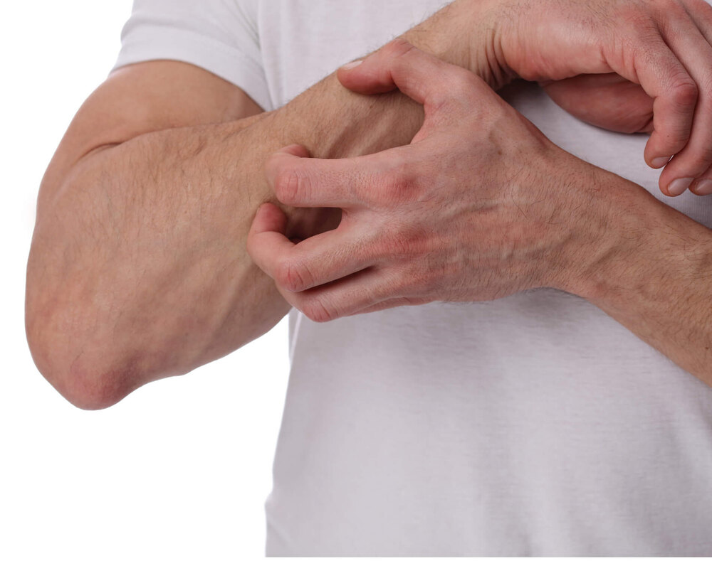 الفا گال سنڈروم- شفا نیوز